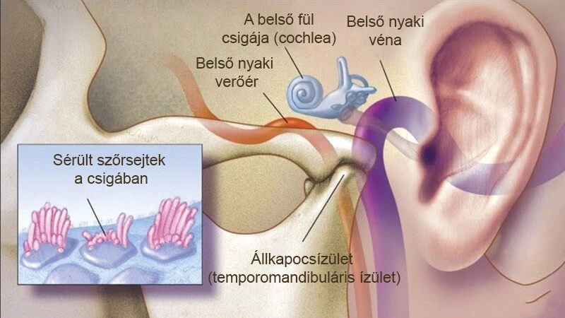 kép